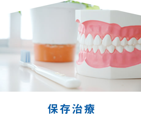 保存治療